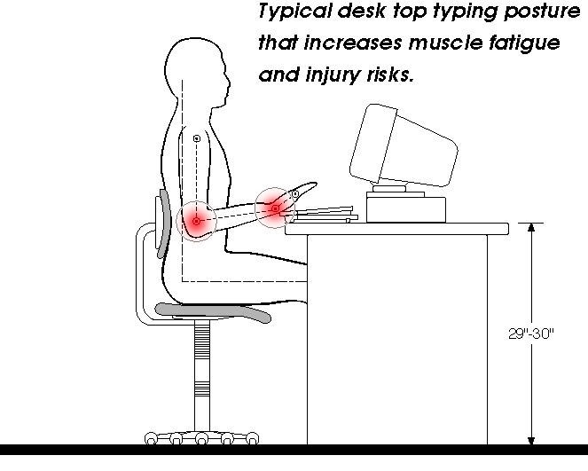 Deviated desk typing posture